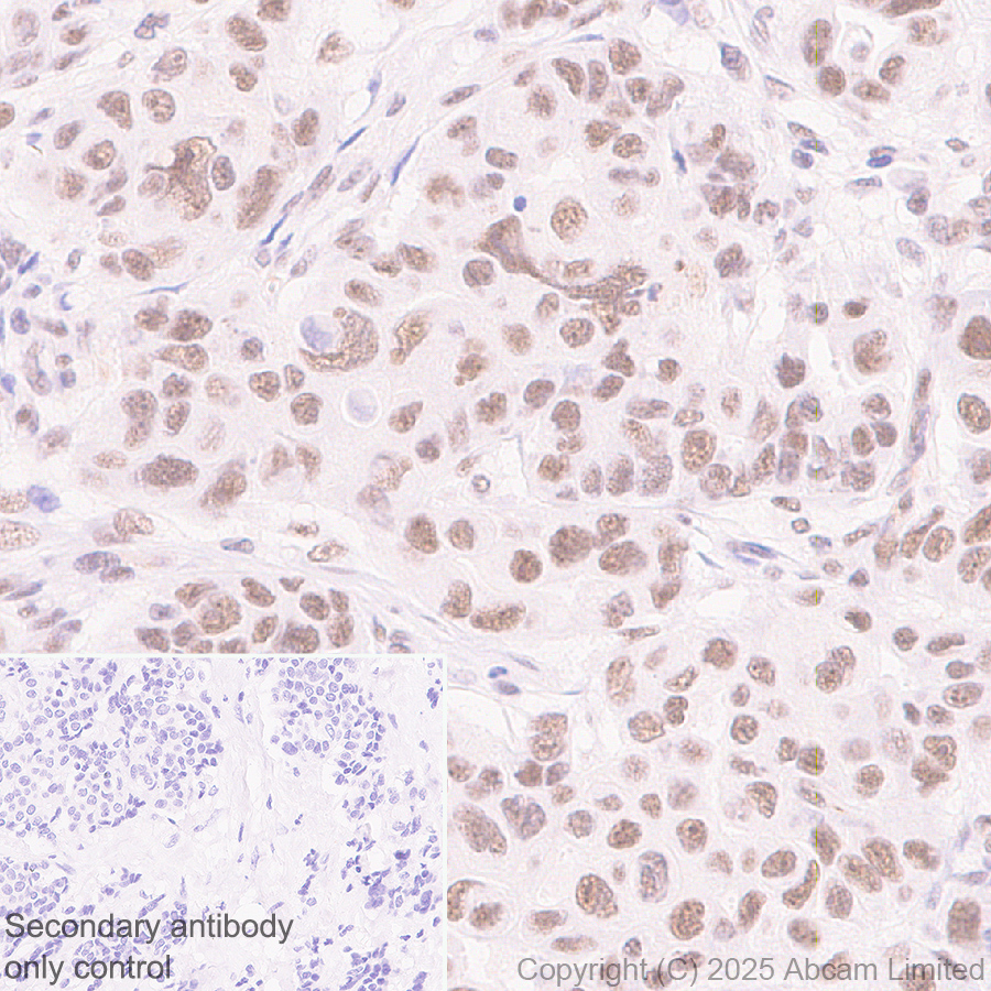 Immunohistochemistry (Formalin/PFA-fixed paraffin-embedded sections) - Anti-CDK13 antibody [EPR29353-534] (AB323865), expandable thumbnail