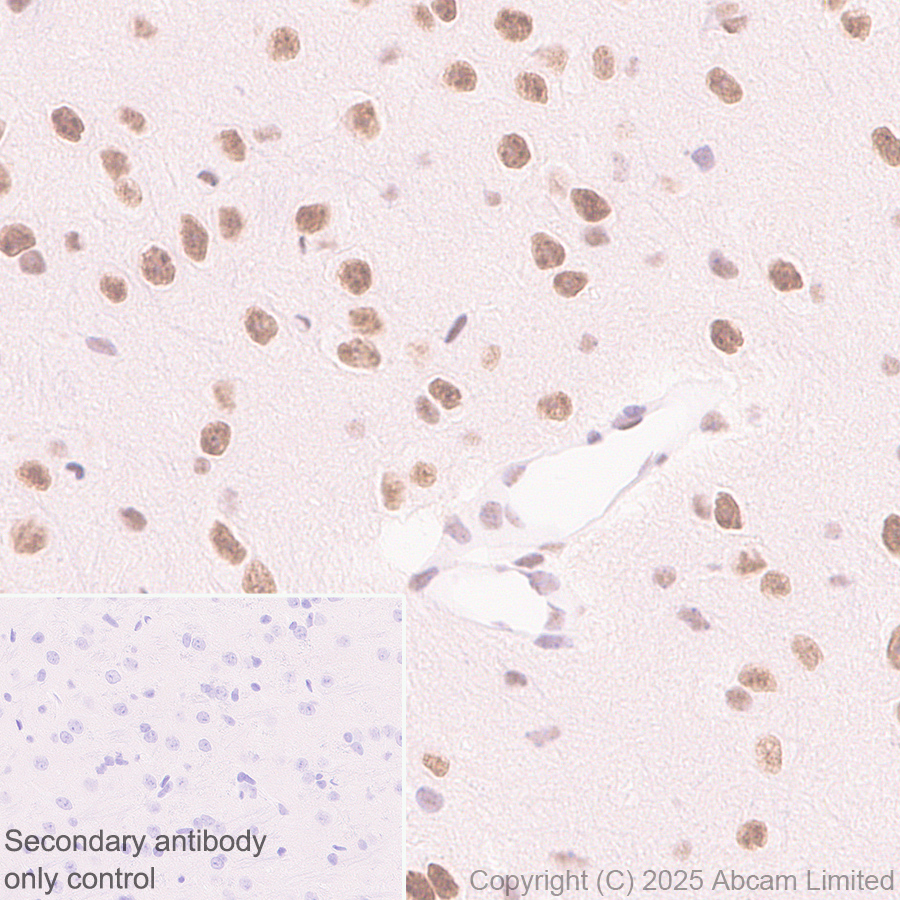 Immunohistochemistry (Formalin/PFA-fixed paraffin-embedded sections) - Anti-CDK13 antibody [EPR29353-534] (ab323865), expandable thumbnail