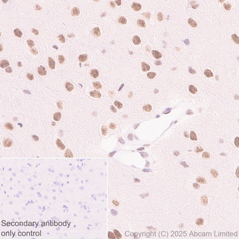Immunohistochemistry (Formalin/PFA-fixed paraffin-embedded sections) - Anti-CDK13 antibody [EPR29353-534] (AB323865)