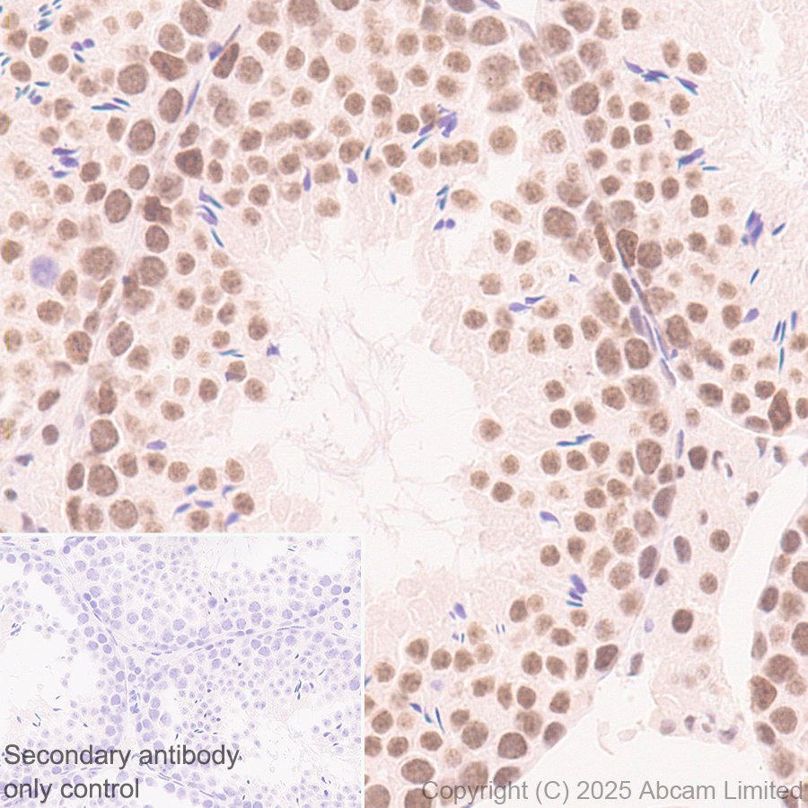 Immunohistochemistry (Formalin/PFA-fixed paraffin-embedded sections) - Anti-CDK13 antibody [EPR29353-534] (AB323865), expandable thumbnail