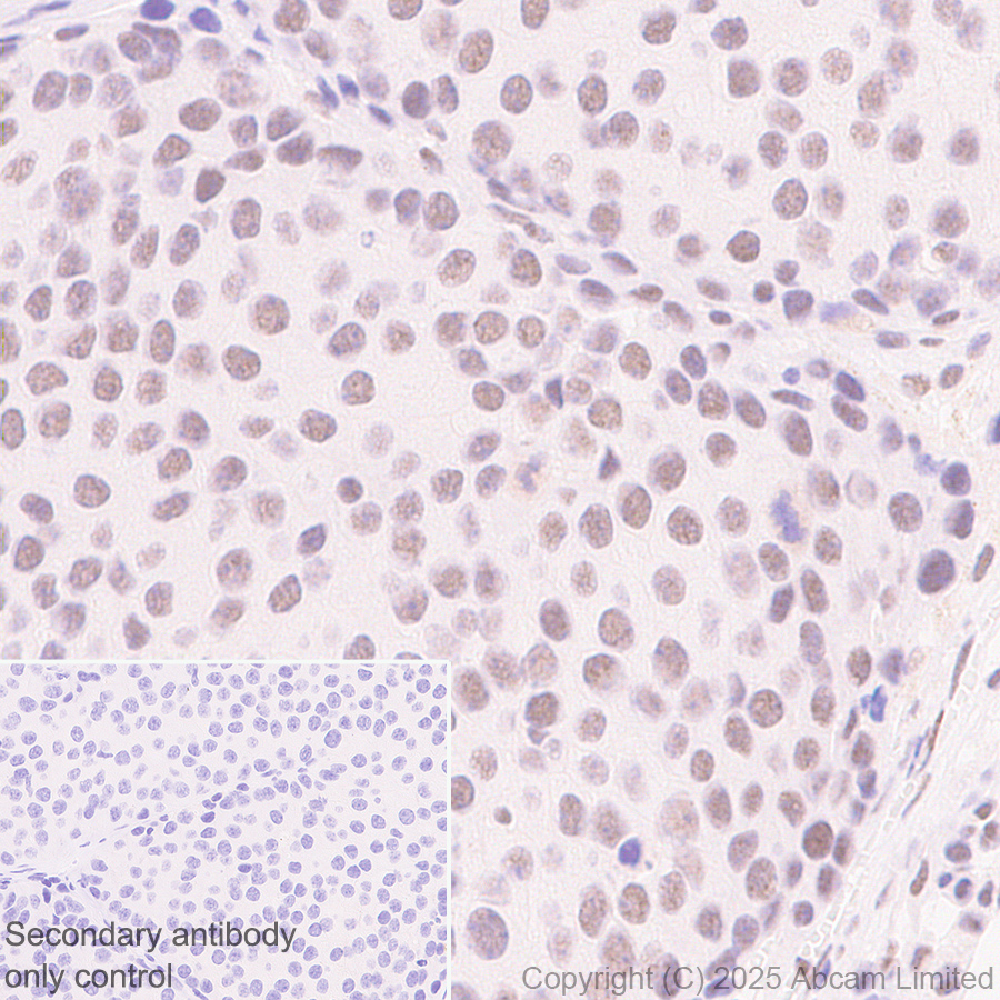 Immunohistochemistry (Formalin/PFA-fixed paraffin-embedded sections) - Anti-CDK13 antibody [EPR29353-534] (ab323865), expandable thumbnail