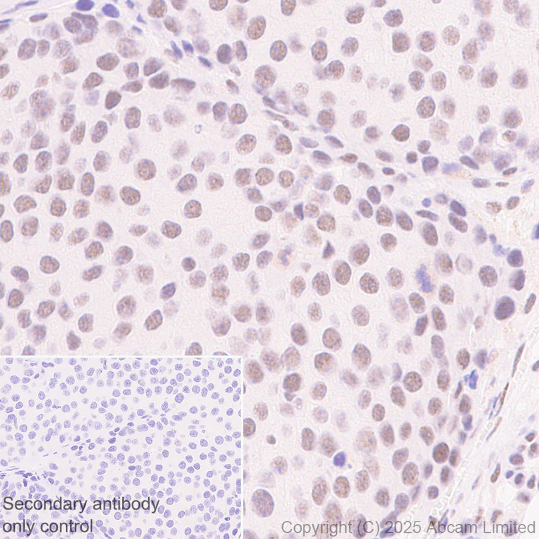 Immunohistochemistry (Formalin/PFA-fixed paraffin-embedded sections) - Anti-CDK13 antibody [EPR29353-534] (AB323865)