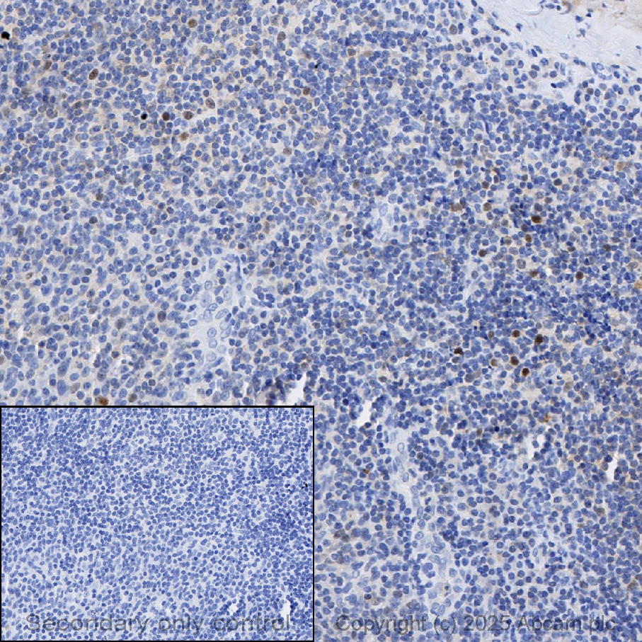 Anti-Cdk2 antibody [E304]