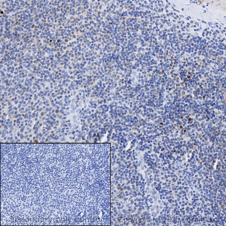 Immunohistochemistry (Formalin/PFA-fixed paraffin-embedded sections) - Anti-Cdk2 antibody [E304] (AB32147)