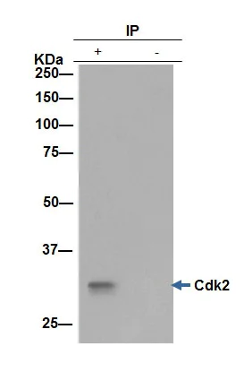 Immunoprecipitation - Anti-Cdk2 antibody [E304] (AB32147)