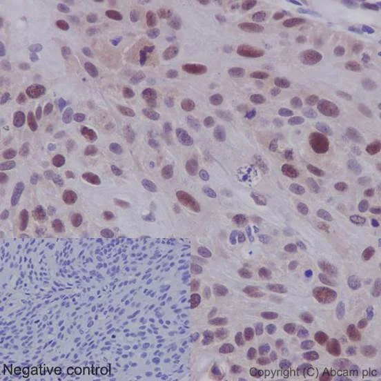 Immunohistochemistry (Formalin/PFA-fixed paraffin-embedded sections) - Anti-Cdk2 antibody [E304] - BSA and Azide free (AB208697)