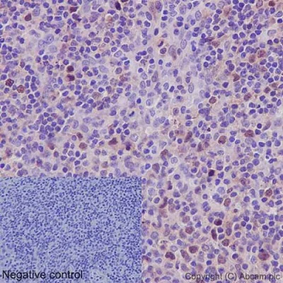 Immunohistochemistry (Formalin/PFA-fixed paraffin-embedded sections) - Anti-Cdk2 antibody [E304] - BSA and Azide free (AB208697)