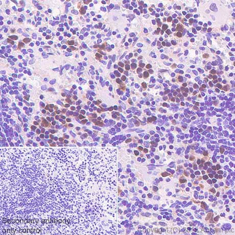 Immunohistochemistry (Formalin/PFA-fixed paraffin-embedded sections) - Anti-Cdk2 antibody [SP80] - BSA and Azide free (AB240937)
