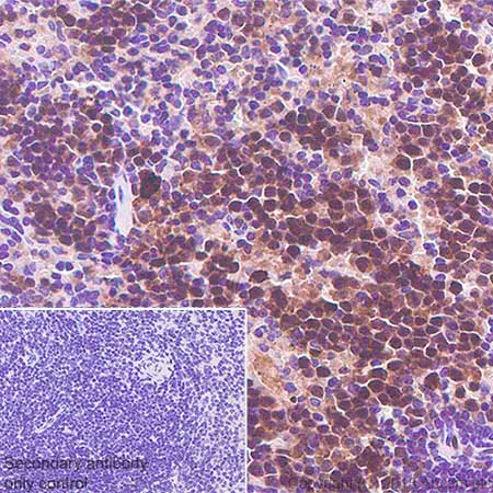 Immunohistochemistry (Formalin/PFA-fixed paraffin-embedded sections) - Anti-Cdk2 antibody [SP80] - BSA and Azide free (AB240937)