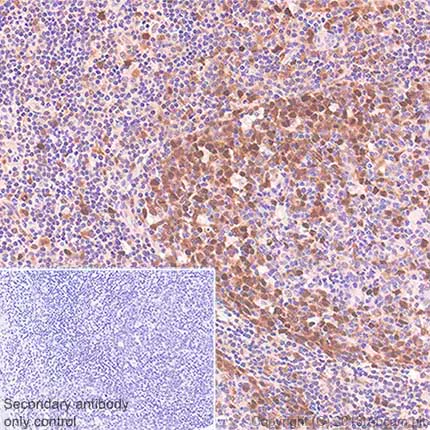 Immunohistochemistry (Formalin/PFA-fixed paraffin-embedded sections) - Anti-Cdk2 antibody [SP80] - BSA and Azide free (AB240937)