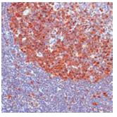 Immunohistochemistry (Formalin/PFA-fixed paraffin-embedded sections) - Anti-Cdk2 antibody [SP80] - BSA and Azide free (AB240937)