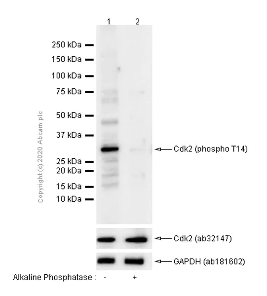 Western blot - Anti-CDK2 (phospho T14) antibody [EP2234Y] (AB68265)