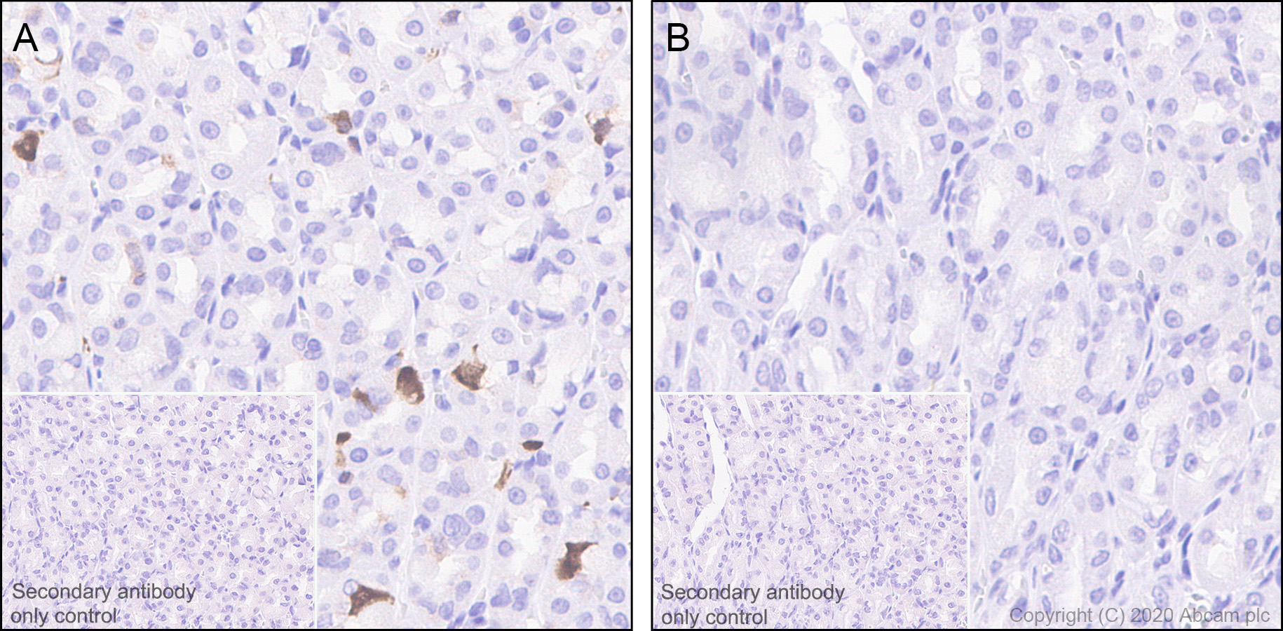 Immunohistochemistry (Formalin/PFA-fixed paraffin-embedded sections) - Anti-CDK2 (phospho T14) antibody [EP2234Y] - BSA and Azide free (AB239860), expandable thumbnail