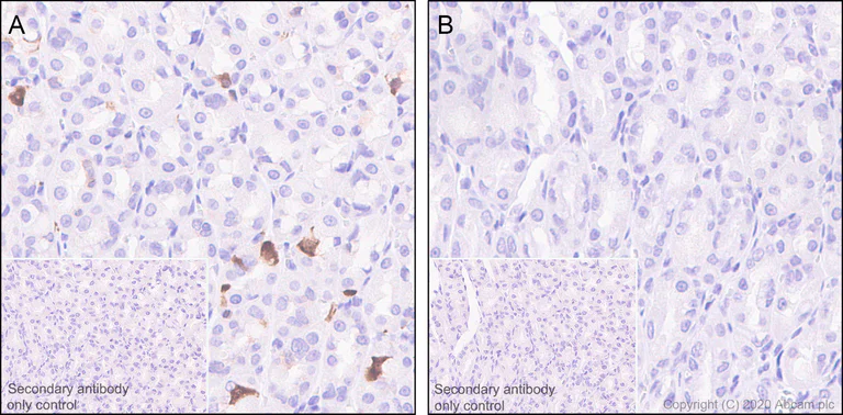 Immunohistochemistry (Formalin/PFA-fixed paraffin-embedded sections) - Anti-CDK2 (phospho T14) antibody [EP2234Y] - BSA and Azide free (AB239860)