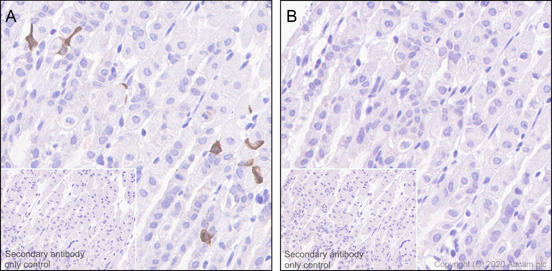 Immunohistochemistry (Formalin/PFA-fixed paraffin-embedded sections) - Anti-CDK2 (phospho T14) antibody [EP2234Y] - BSA and Azide free (AB239860), expandable thumbnail