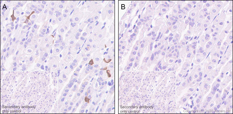 Immunohistochemistry (Formalin/PFA-fixed paraffin-embedded sections) - Anti-CDK2 (phospho T14) antibody [EP2234Y] - BSA and Azide free (AB239860)