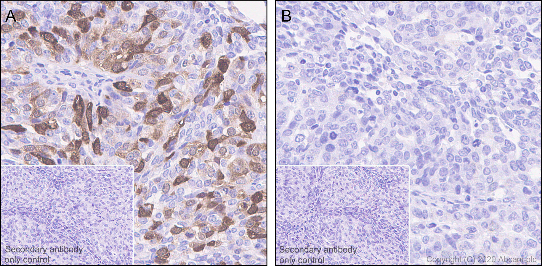 Immunohistochemistry (Formalin/PFA-fixed paraffin-embedded sections) - Anti-CDK2 (phospho T14) antibody [EP2234Y] - BSA and Azide free (AB239860), expandable thumbnail