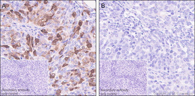 Immunohistochemistry (Formalin/PFA-fixed paraffin-embedded sections) - Anti-CDK2 (phospho T14) antibody [EP2234Y] - BSA and Azide free (AB239860)
