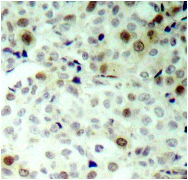 Immunohistochemistry (Formalin/PFA-fixed paraffin-embedded sections) - Anti-Cdk2 (phospho T160) antibody (AB194868)