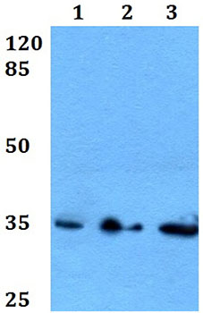 Western blot - Anti-Cdk3 antibody (AB191503)
