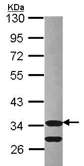 Western blot - Anti-Cdk3 antibody (AB96847)