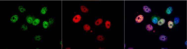 Immunocytochemistry/ Immunofluorescence - Anti-Cdk4 antibody (AB137675)