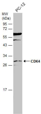 Western blot - Anti-Cdk4 antibody (AB137675)