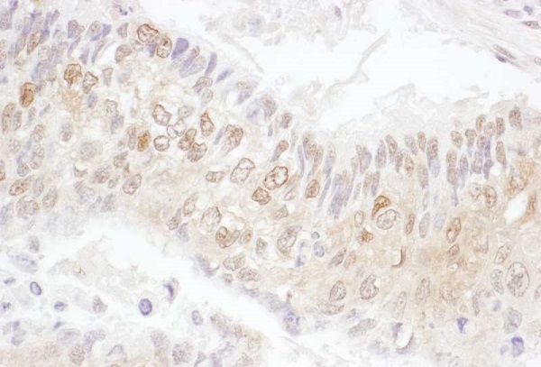 Immunohistochemistry (Formalin/PFA-fixed paraffin-embedded sections) - Anti-Cdk4 antibody (AB226474), expandable thumbnail