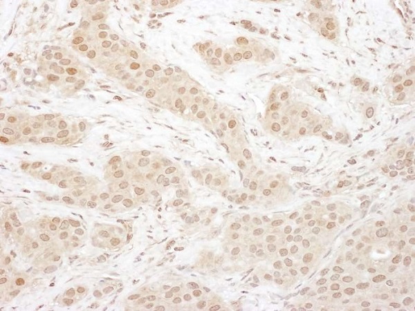 Immunohistochemistry (Formalin/PFA-fixed paraffin-embedded sections) - Anti-Cdk4 antibody (AB226474), expandable thumbnail