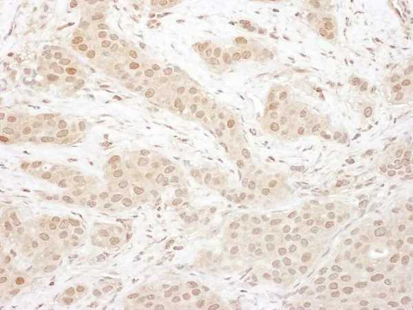 Immunohistochemistry (Formalin/PFA-fixed paraffin-embedded sections) - Anti-Cdk4 antibody (AB226474)