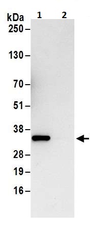 Immunoprecipitation - Anti-Cdk4 antibody (AB226474), expandable thumbnail