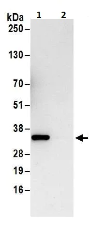 Immunoprecipitation - Anti-Cdk4 antibody (AB226474)