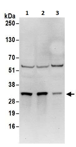 Western blot - Anti-Cdk4 antibody (AB226474), expandable thumbnail