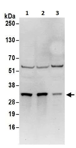 Western blot - Anti-Cdk4 antibody (AB226474)