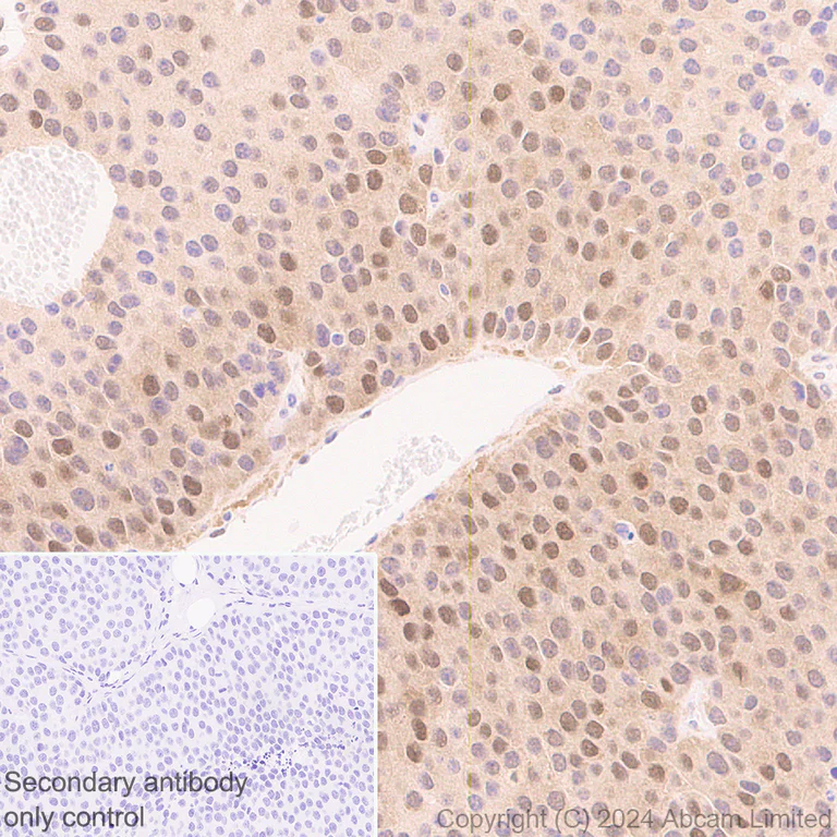 Immunohistochemistry (Formalin/PFA-fixed paraffin-embedded sections) - Anti-CDK4 antibody [EPR28092-70] - BSA and Azide free (AB324785)