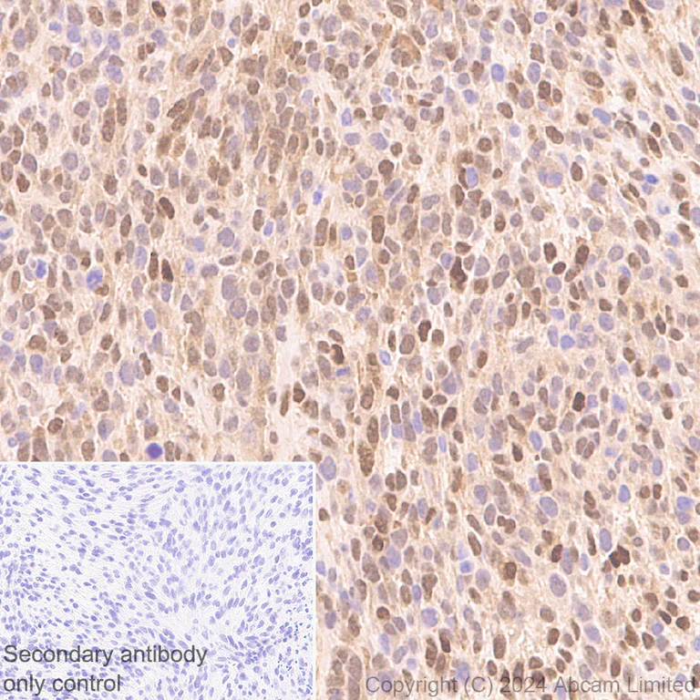 Immunohistochemistry (Formalin/PFA-fixed paraffin-embedded sections) - Anti-CDK4 antibody [EPR28092-70] - BSA and Azide free (AB324785)