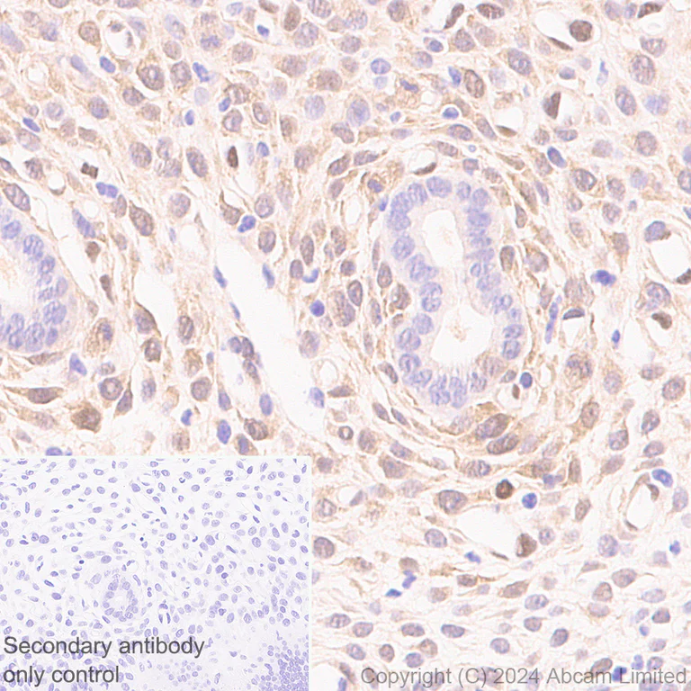 Immunohistochemistry (Formalin/PFA-fixed paraffin-embedded sections) - Anti-CDK4 antibody [EPR28092-70] - BSA and Azide free (AB324785)