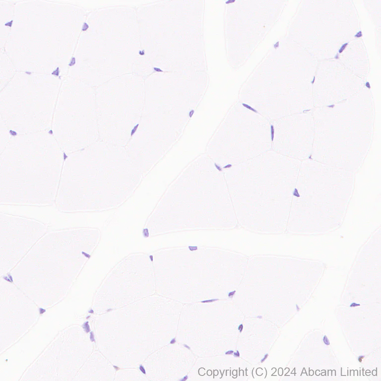 Immunohistochemistry (Formalin/PFA-fixed paraffin-embedded sections) - Anti-CDK4 antibody [EPR28092-70] - BSA and Azide free (AB324785)