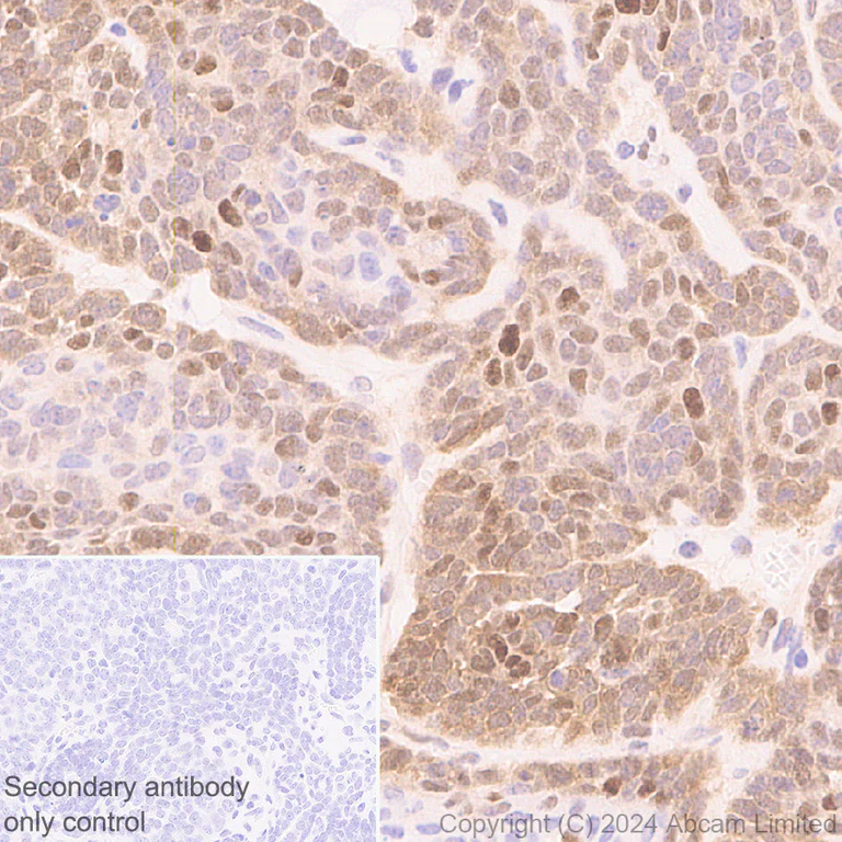 Immunohistochemistry (Formalin/PFA-fixed paraffin-embedded sections) - Anti-CDK4 antibody [EPR28092-70] - BSA and Azide free (AB324785)