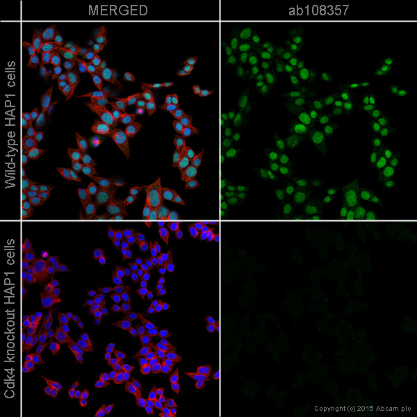 Immunocytochemistry/ Immunofluorescence - Anti-Cdk4 antibody [EPR4513-32-7] - BSA and Azide free (ab213216), expandable thumbnail