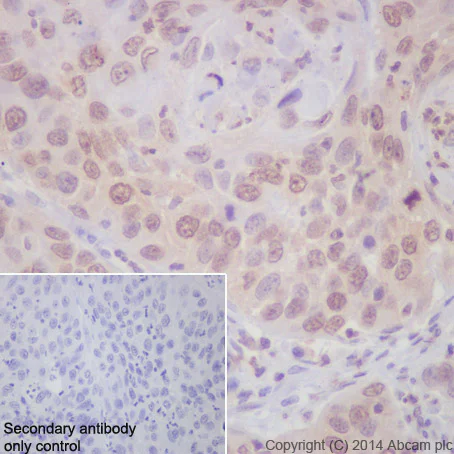 Immunohistochemistry (Formalin/PFA-fixed paraffin-embedded sections) - Anti-Cdk4 antibody [EPR4513-32-7] - BSA and Azide free (AB213216)
