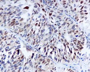 Immunohistochemistry (Formalin/PFA-fixed paraffin-embedded sections) - Anti-Cdk4 antibody [EPR4513-32-7] - BSA and Azide free (ab213216), expandable thumbnail