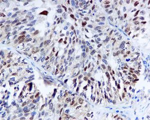 Immunohistochemistry (Formalin/PFA-fixed paraffin-embedded sections) - Anti-Cdk4 antibody [EPR4513-32-7] - BSA and Azide free (AB213216)