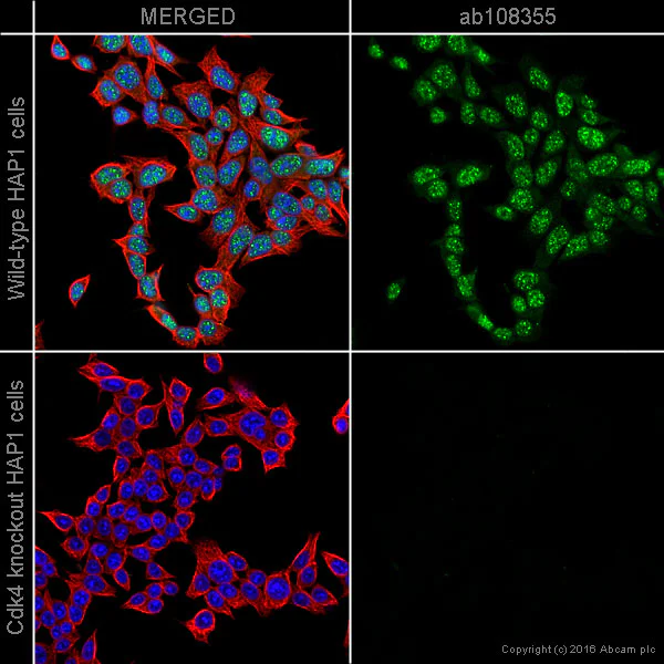 Immunocytochemistry/ Immunofluorescence - Anti-Cdk4 antibody [EPR4513-54-3] - BSA and Azide free (AB247645)