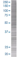 SDS-PAGE - Cdk4 overexpression 293T lysate (whole cell) (AB94290)