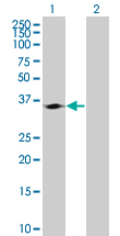 Western blot - Cdk4 overexpression 293T lysate (whole cell) (AB94290)