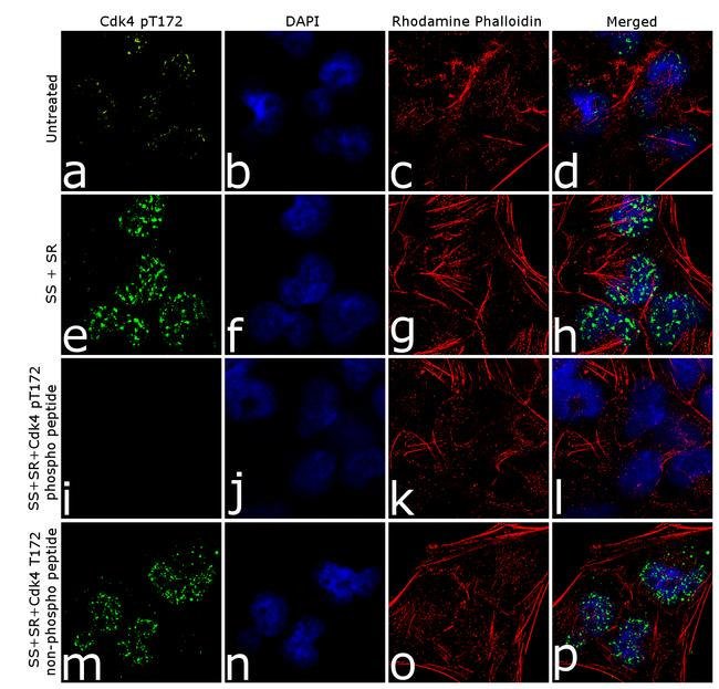 Immunocytochemistry/ Immunofluorescence - Anti-Cdk4 (phospho T172) antibody [9HCLC] (AB277788)