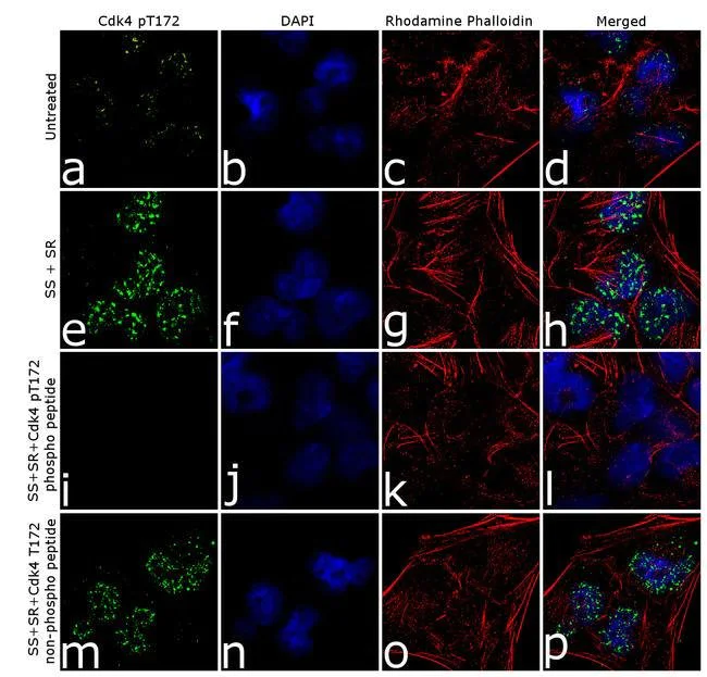 Immunocytochemistry/ Immunofluorescence - Anti-Cdk4 (phospho T172) antibody [9HCLC] (AB277788)
