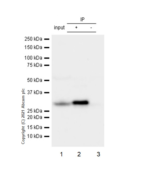Immunoprecipitation - Anti-CDK5 antibody [EP715Y] (AB40773), expandable thumbnail