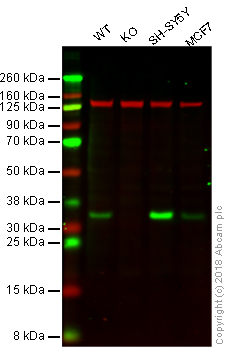 Western blot - Anti-CDK5 antibody [EP715Y] (AB40773), expandable thumbnail